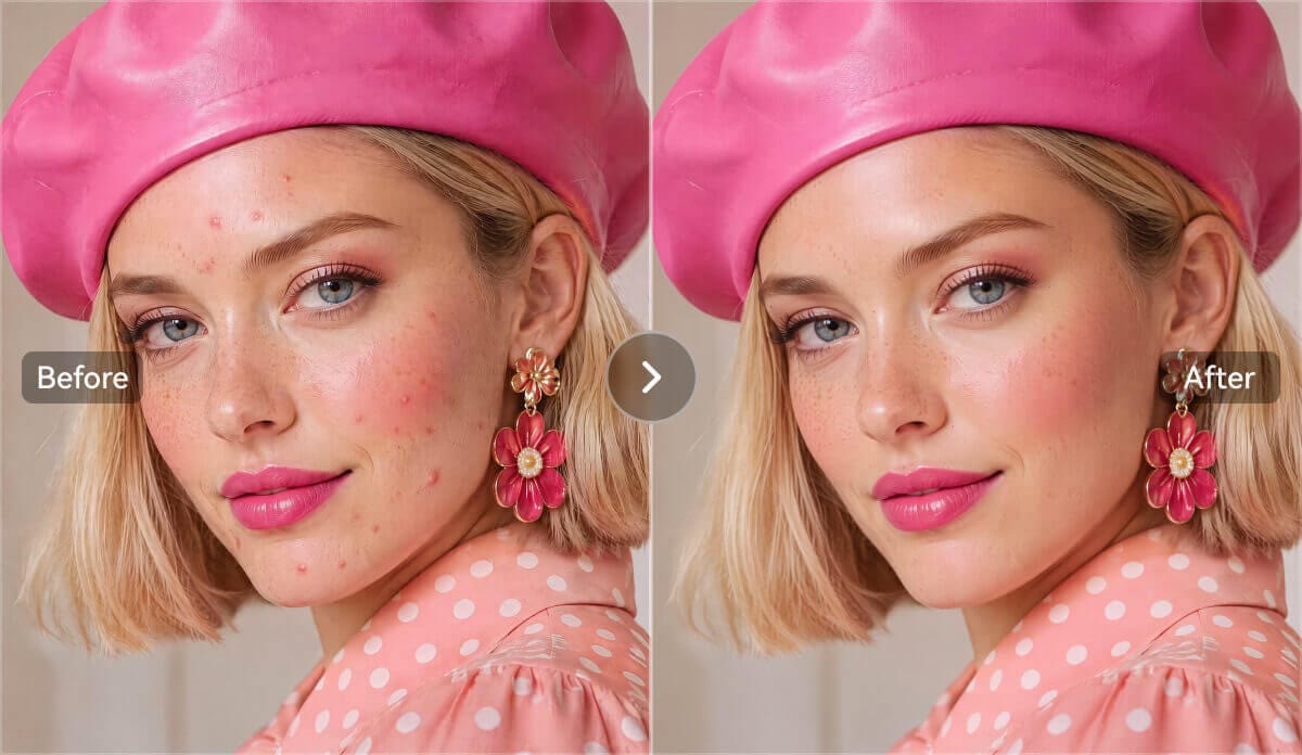 Blemishes out, smooth skin in